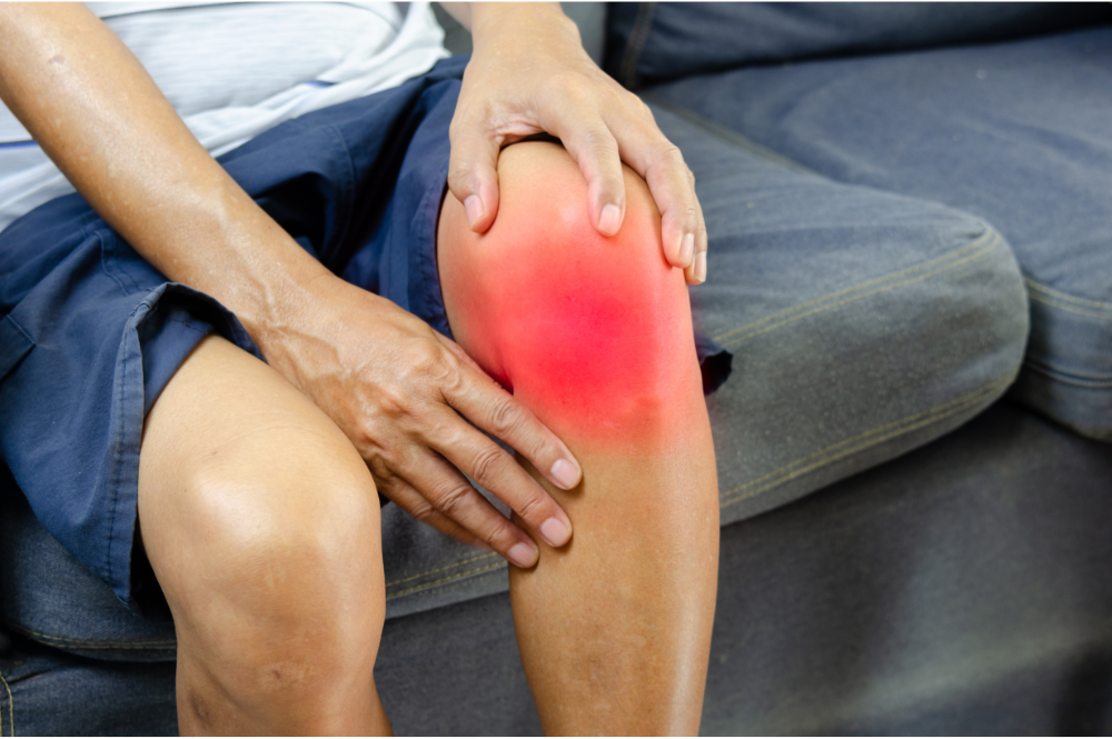 arthritis right knee pain icd 10